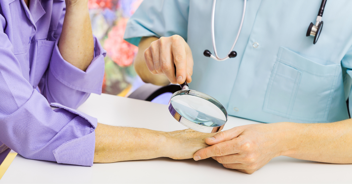 A dermatologist with a magnifying glass on a woman's hand.
